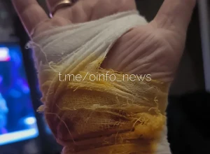 «Перекушена часть кисти»: в Трёхгорке хозяйка собачки пострадала от крупного пса, защищая питомца